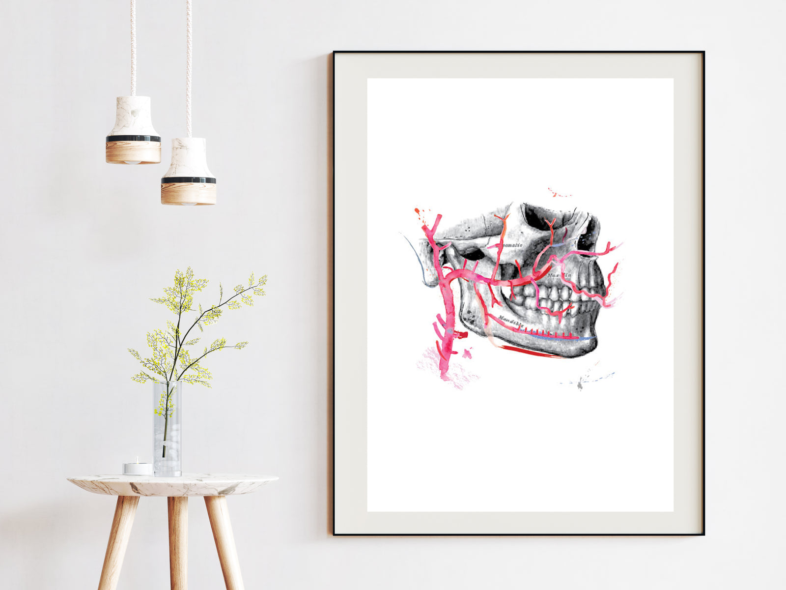 Maxilla and Arteria Maxillaris Dental Oral and Maxillofacial Surgery Art Print