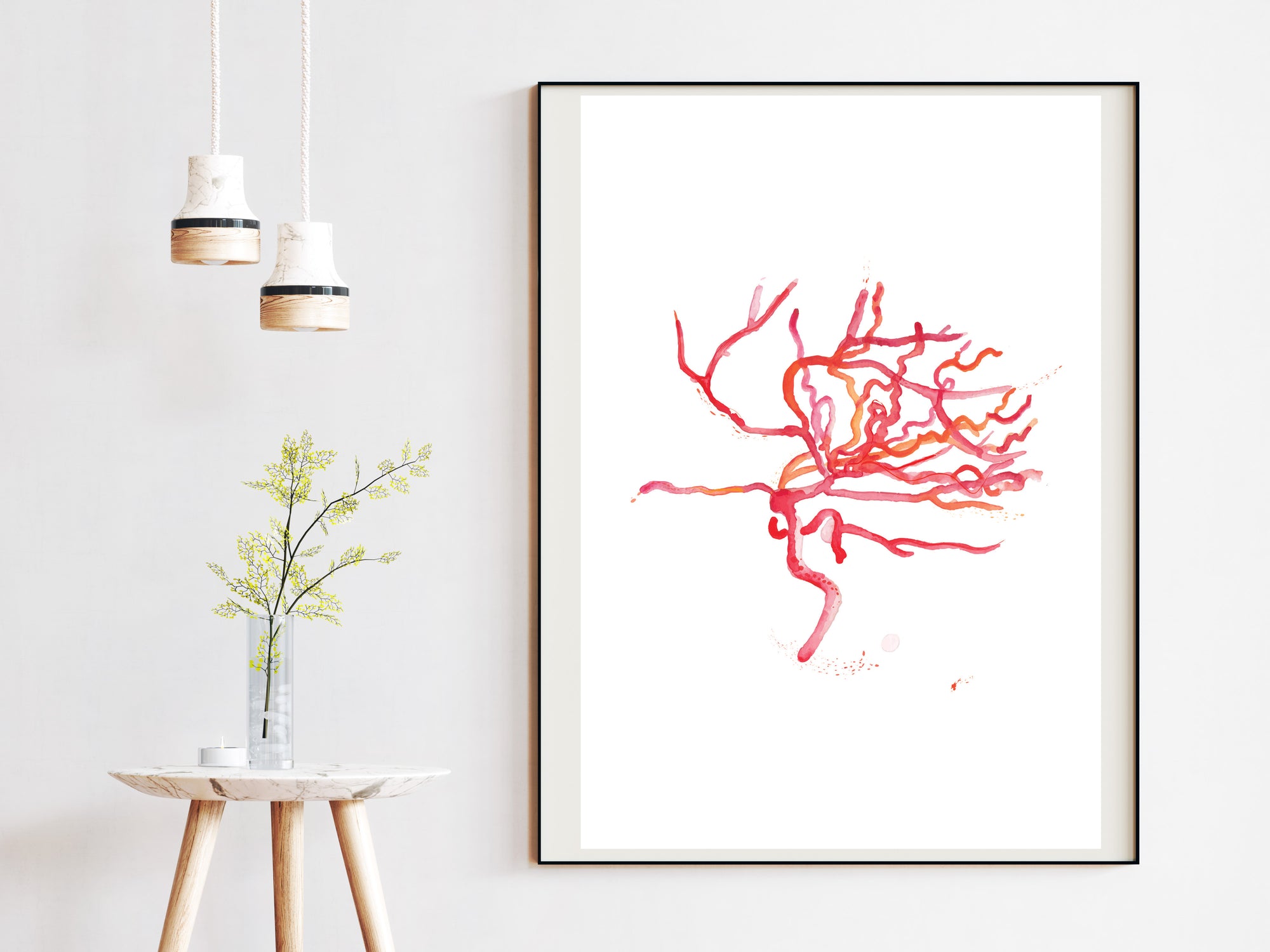 Brain Arteries Angiography Art, Neurology Wall Art, Brain Artery Anatomy