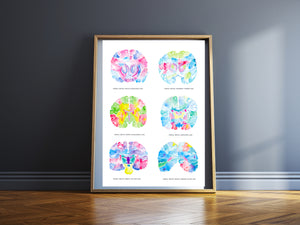 neurology art print