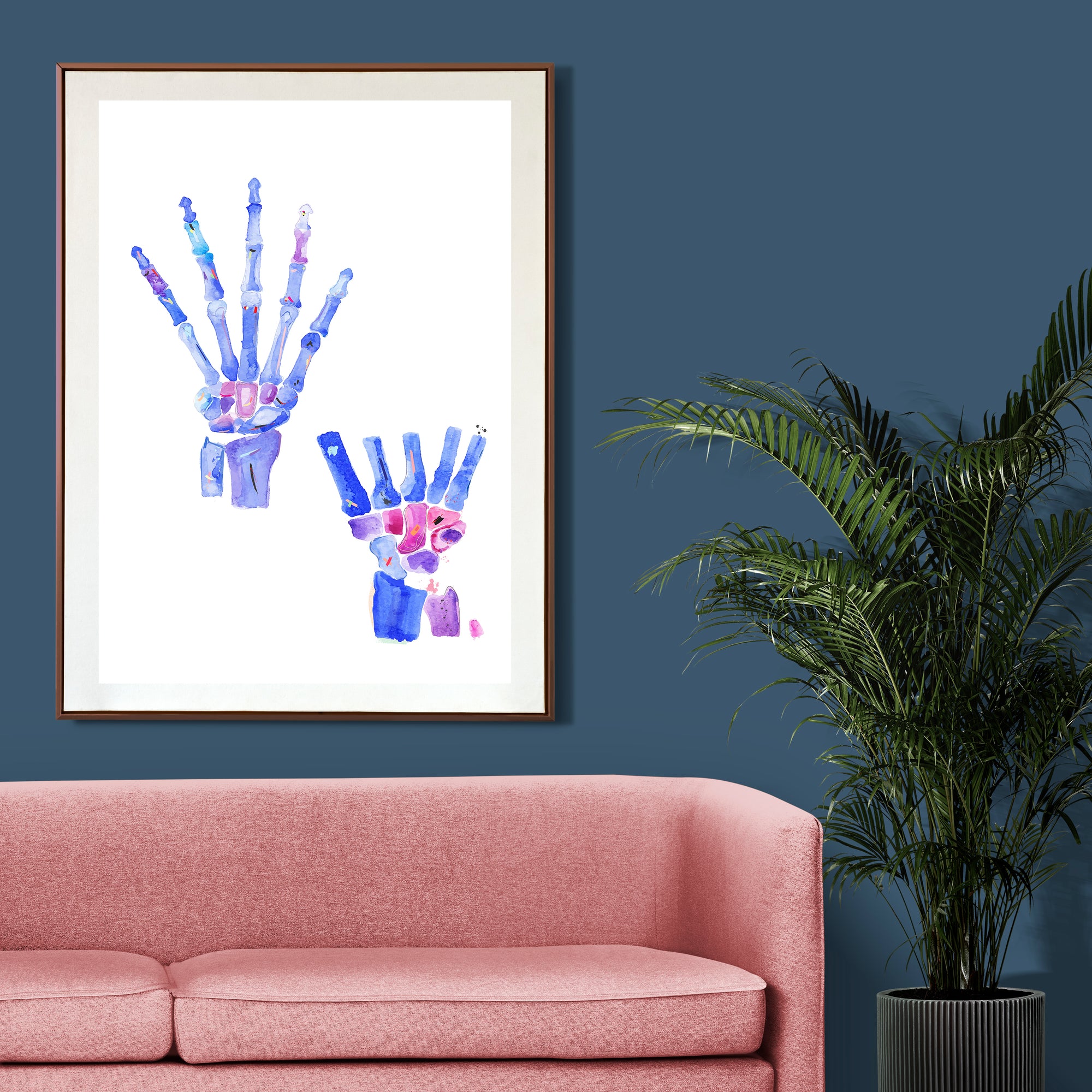 Hand and Wrist Anatomy, Orthopedic Surgery Art, Physical Therapy Office Decor