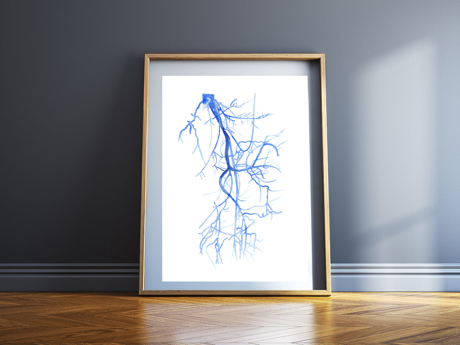Lower Limb Angiography, Iliofemoral Section, Vascular Surgery and Radiology Art Print