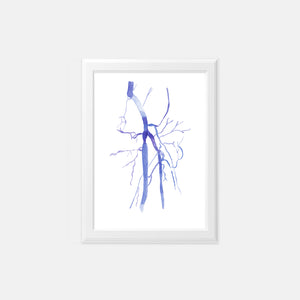 artery vascular anatomy art