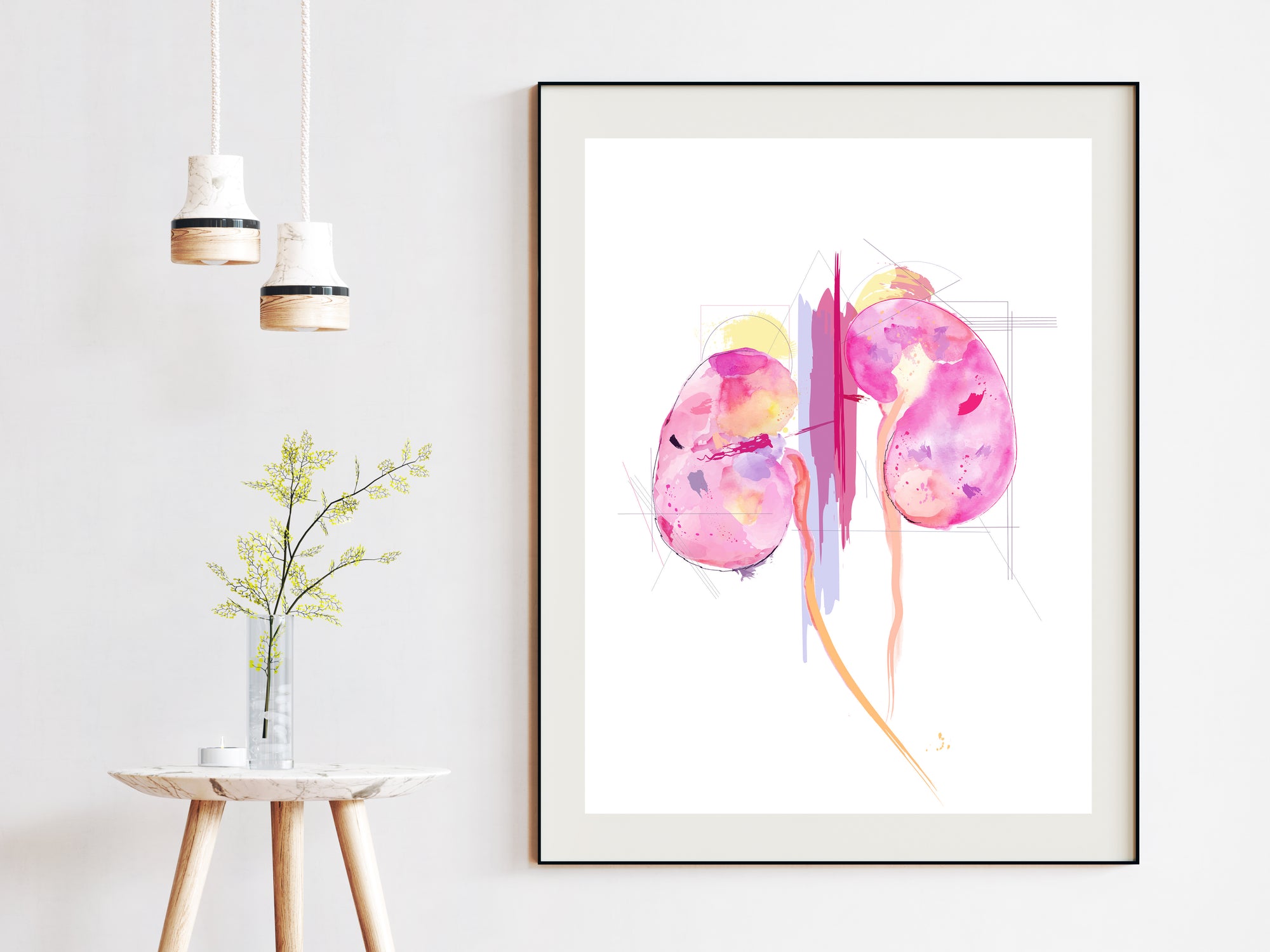 Kidney Art, Abstract Anatomy Art, Nephrology Office Art