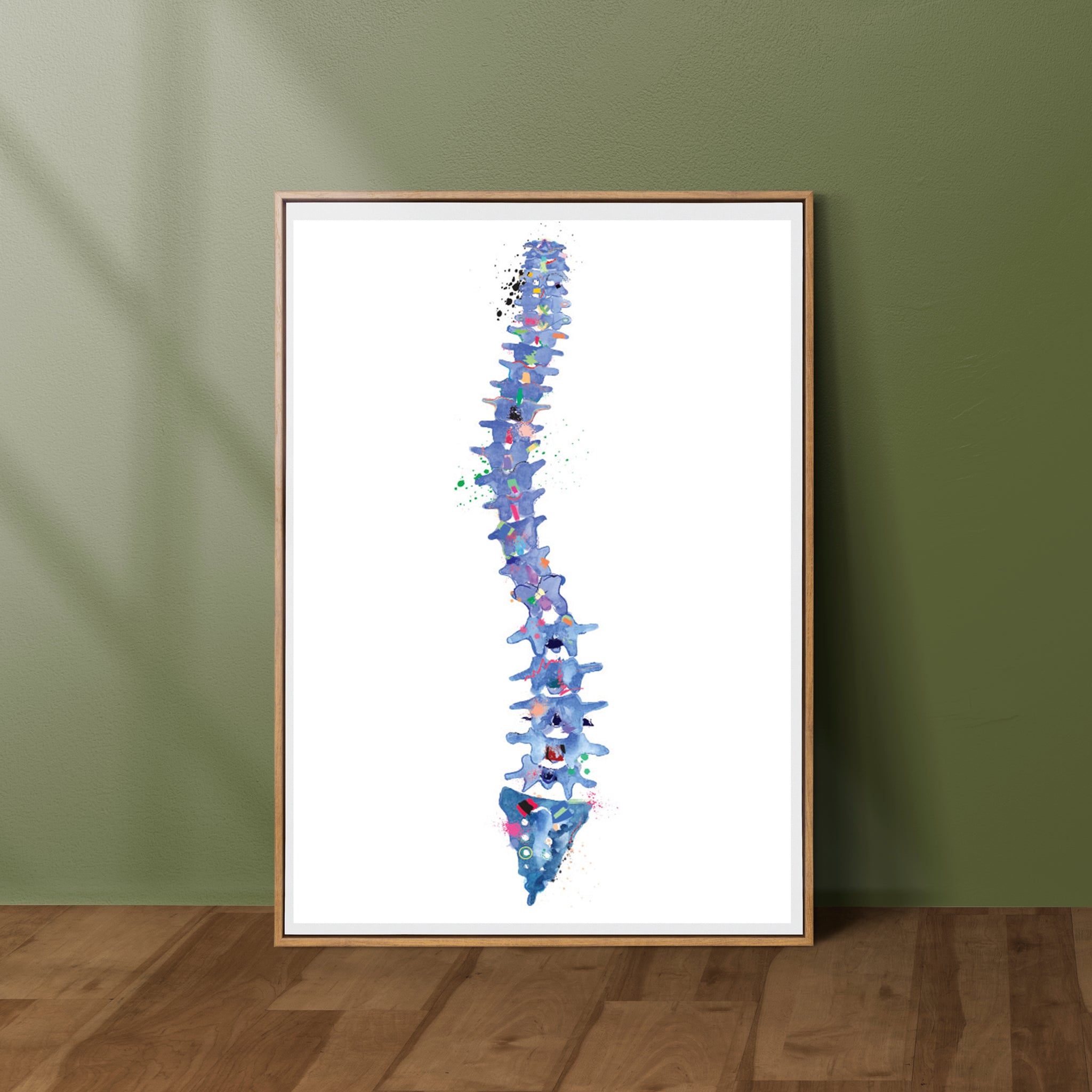 Scoliosis Art Print - medpapers