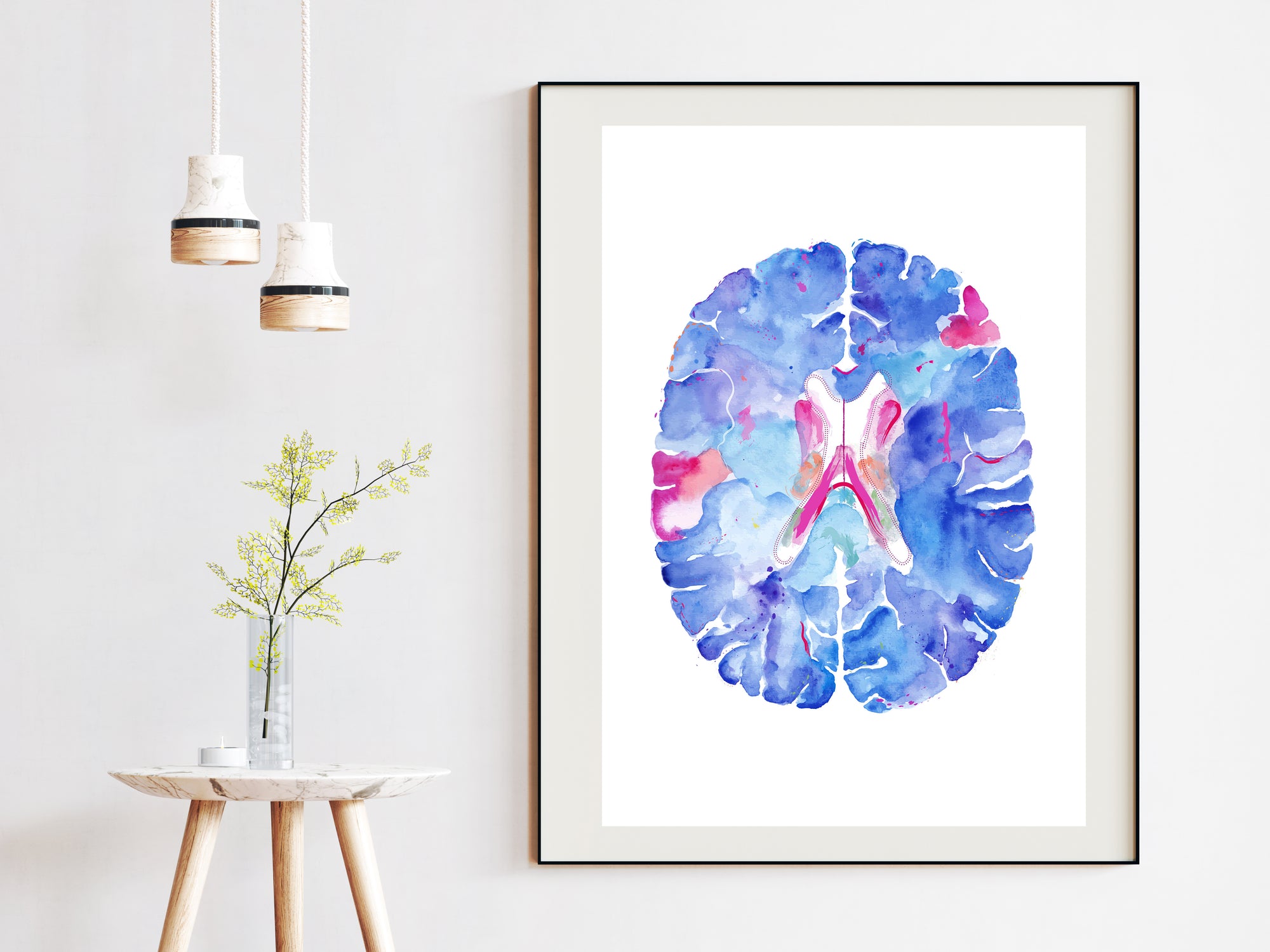 neurology neurosurgery art print