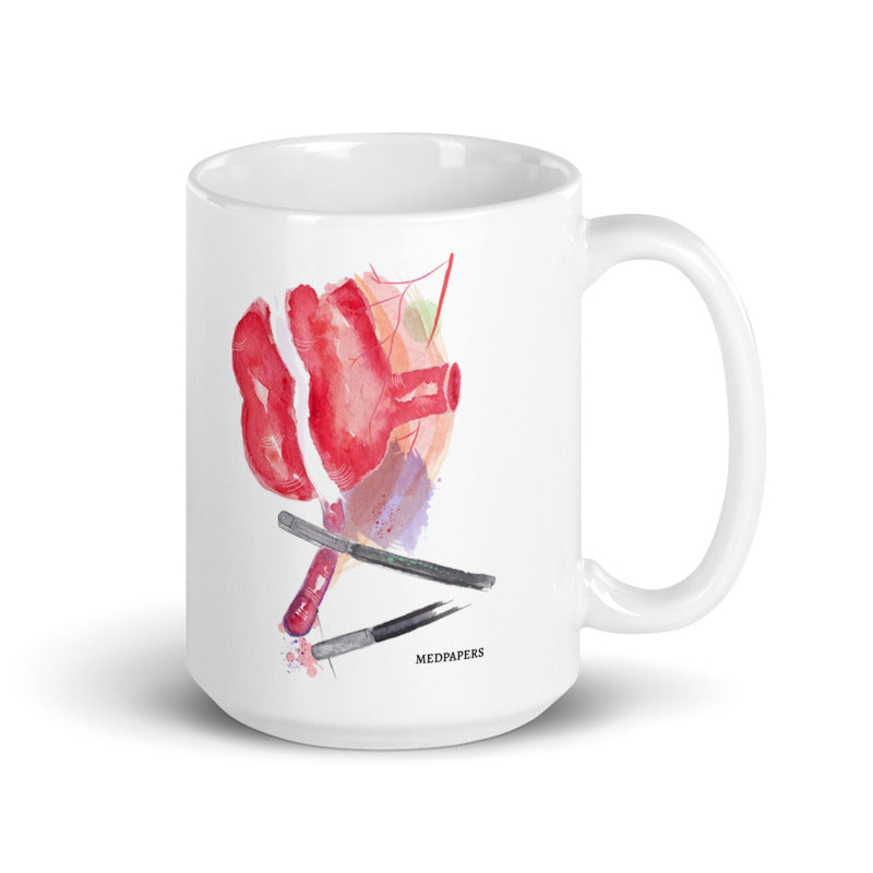 laparoscopic appendectomy art