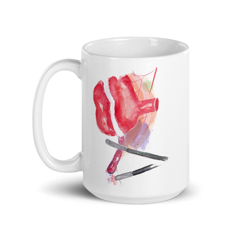 laparoscopic appendectomy art