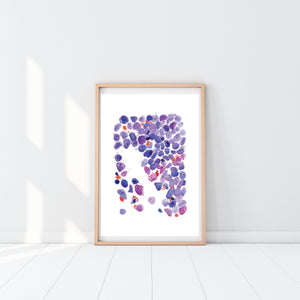 Acute Myeloid Leukemia Art Print, Hematopathology Art, Hematologist Office Art, Hematologist Gift, Pathologist Gift, Laboratory Artwork, AML