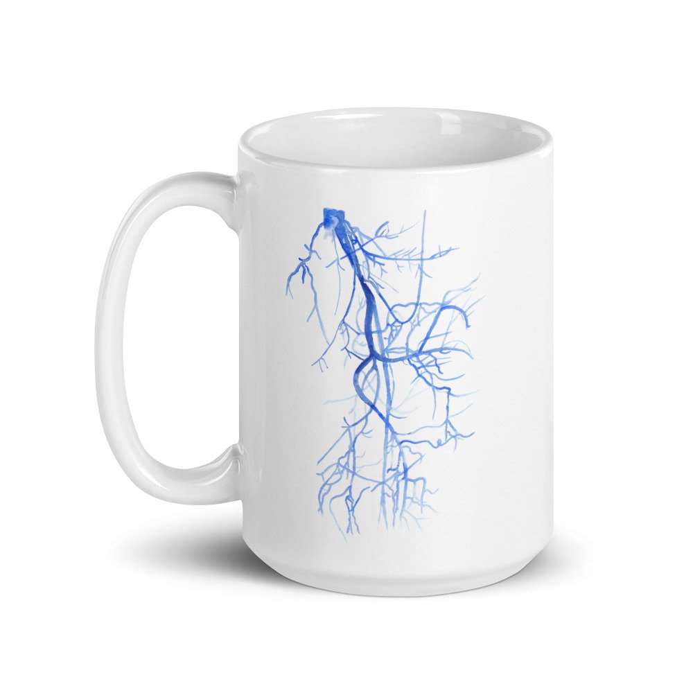 Radiology Mug, Vascular Surgery, Radiology Tech, Xray Tech Gift, radiology Graduation, PA Mug, Physician Assistant Mug, Vascular Surgeon
