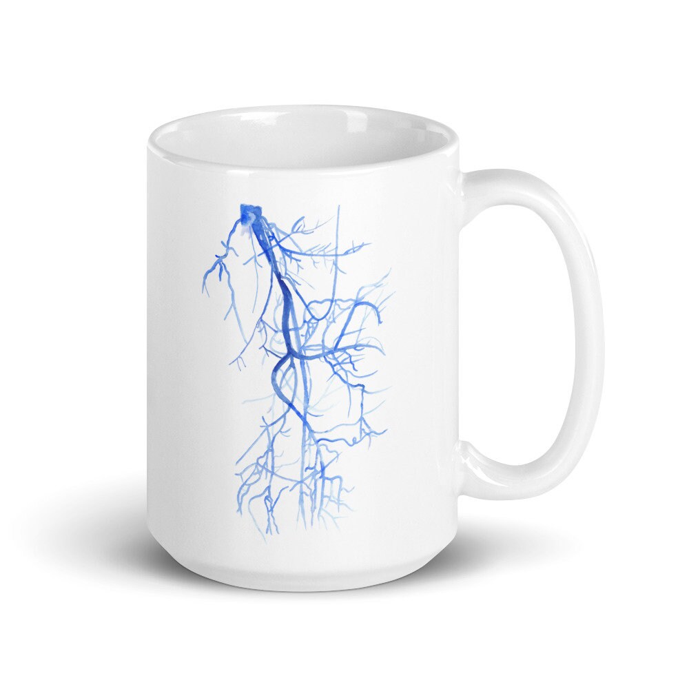 Radiology Mug, Vascular Surgery, Radiology Tech, Xray Tech Gift, radiology Graduation, PA Mug, Physician Assistant Mug, Vascular Surgeon