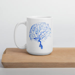 Brain Arteries Mug, Brain CTA Mug, Neurosurgery Mug, Neurosurgeon Gift, Radiology Art, Radiology Tech Gift,