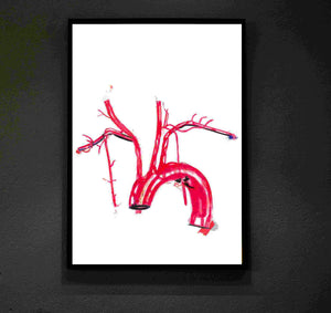 Aorta Anatomy, Aorta Art, Cardiology Art, Human Anatomy Art, Interventional Cardiology Cardiologist Gift, Physician Art, Medical Student Art