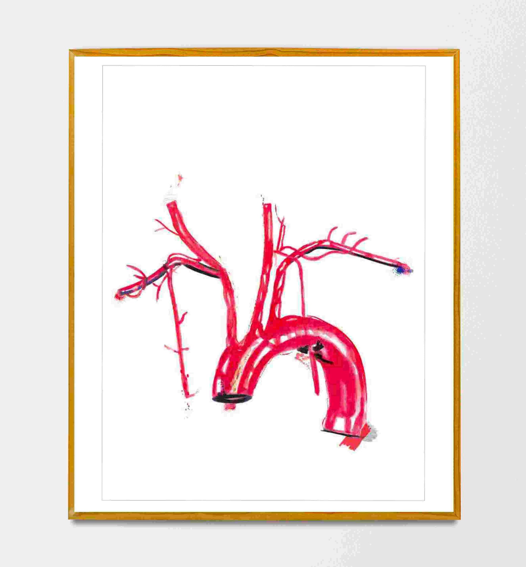 Aorta Anatomy, Aorta Art, Cardiology Art, Human Anatomy Art, Interventional Cardiology Cardiologist Gift, Physician Art, Medical Student Art