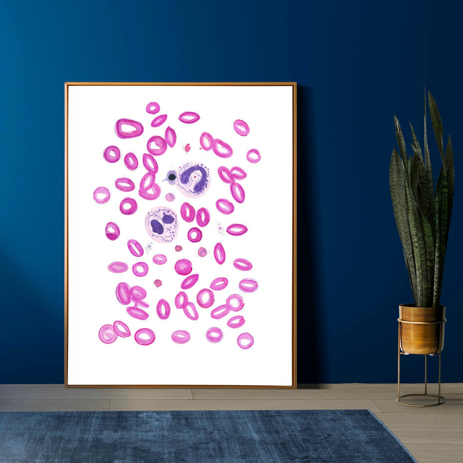 Sickle Cell Anaemia, Anemia Art, Hematology Art, Hematologist Gift, Laboratory Art, Lab Tech Gift, Hematology Nurse, Hematology Gift